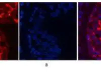 CD68 Monoclonal Antibody(6F3)